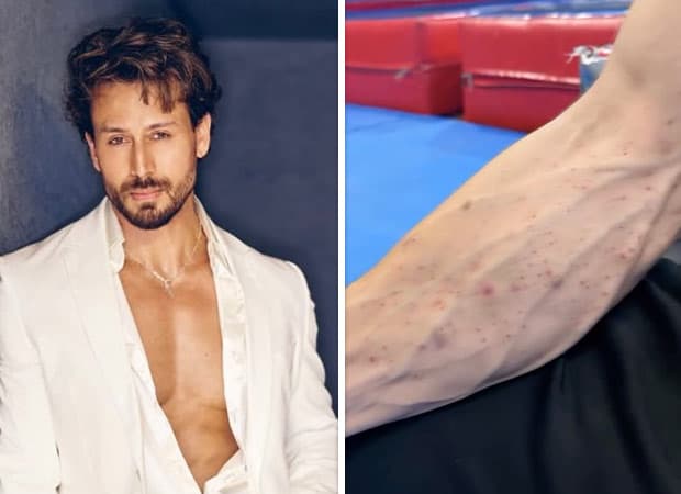 Tiger Shroff shot in Juhu; video shows cuts and bruises